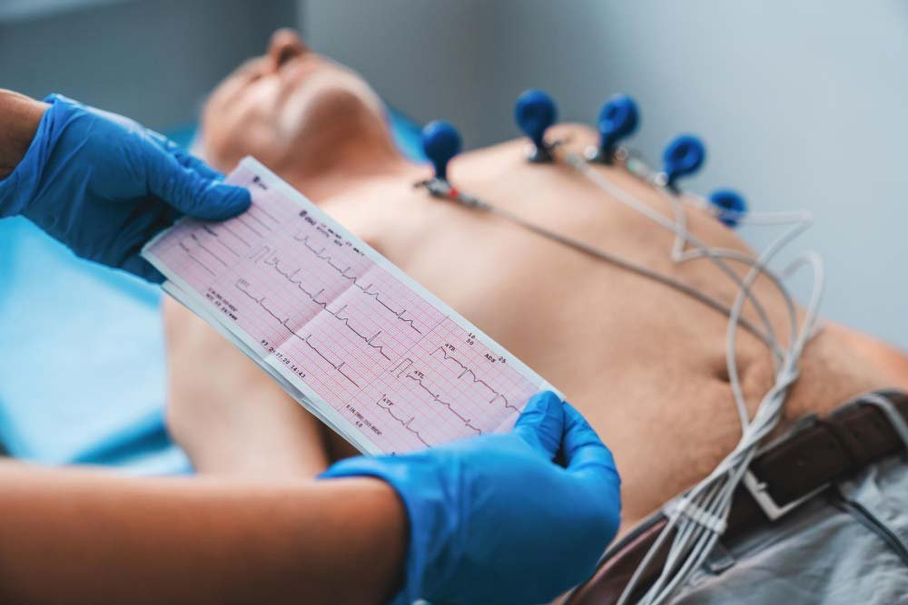 CBD y función cardiovascular